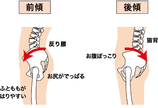 姿勢矯正